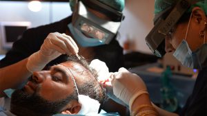 DHI Hair Transplant