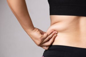 Tummy Tuck