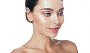 Facelift