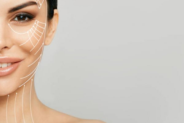 Face Lift