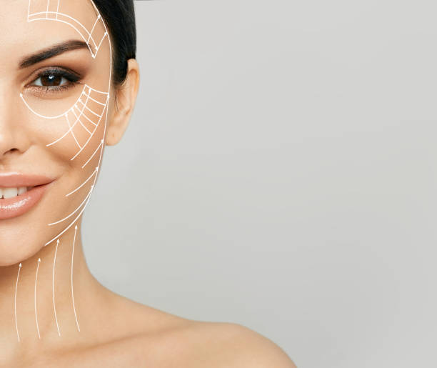 The Ultimate Guide to Getting a Facelift: Everything You Need to Know Before Taking the Plunge