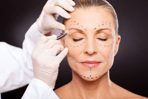 Facelift