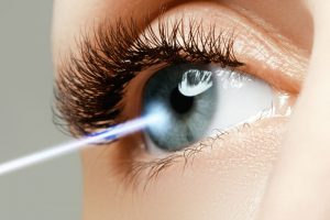 Laser Eye Surgery