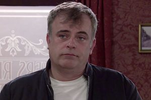 Simon Gregson Hair Loss