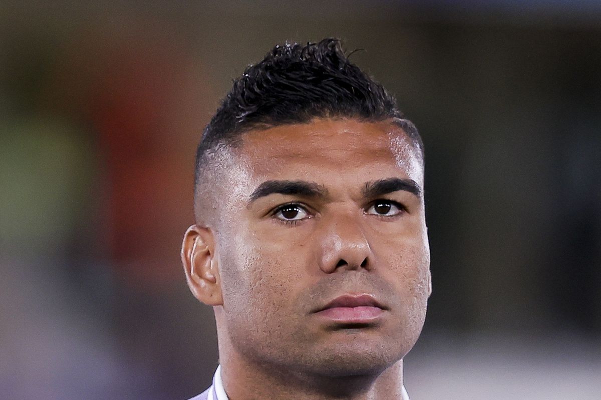 Casemiro Nose Job