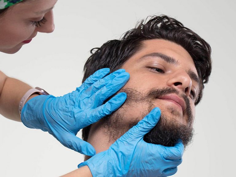 Beard Transplantation in turkey