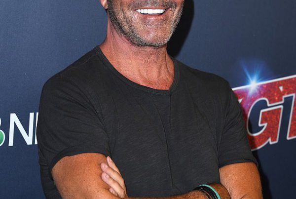 Simon Cowell Facelift Before-After