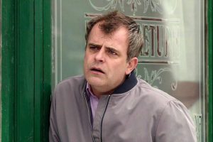 Simon Gregson Hair Transplant FUE