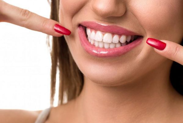 teeth whitening