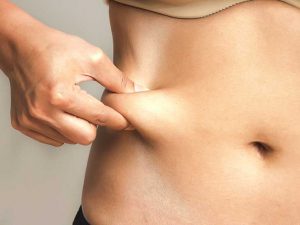 Liposuction Before After