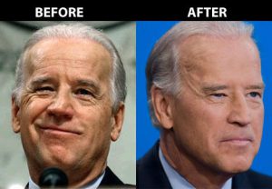 joe biden facelift Before-After