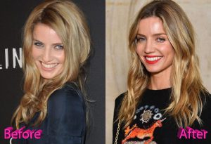 Annabelle Wallis Nose Job