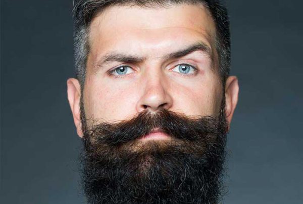 Beard Transplant