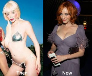 Christina Hendricks Boob Job