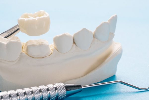 Dental Crowns