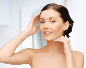 Facelift