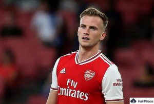 rob holding hair transplant
