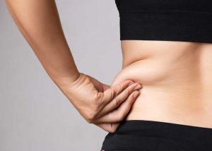 Liposuction