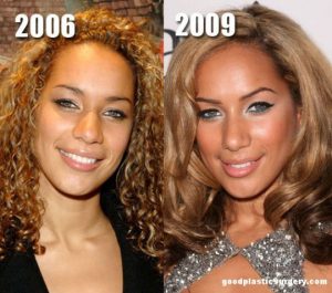Nose Job