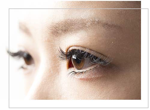 Double Eyelid Surgery