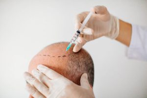 Hair Transplant syringe