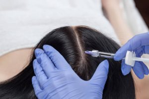 PRP injection women