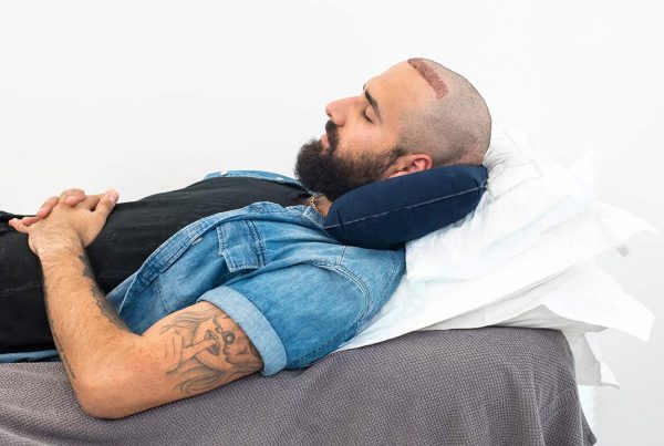 Hair transplant After Spleep