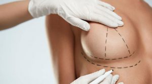 Breast Uplift İn Turkey
