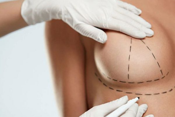 Breast Uplift İn Turkey