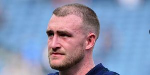 Stuart Hogg hair transplant before