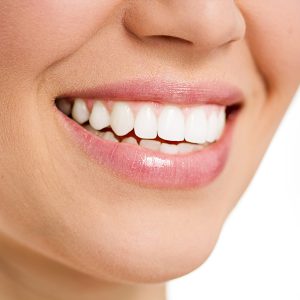 teeth whitening