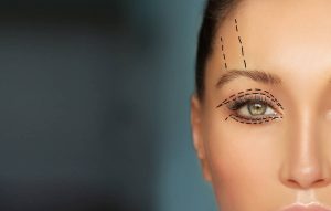 Eyelid
