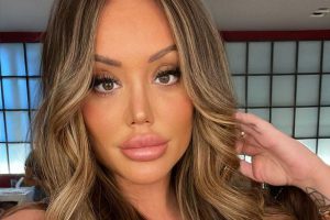 charlotte crosby rhinoplasty operation