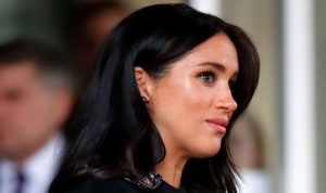 Megan Markle Nose Job