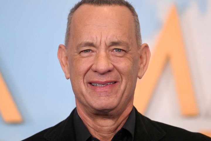 tom hanks hair transplant