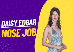 daisy edgar nose job