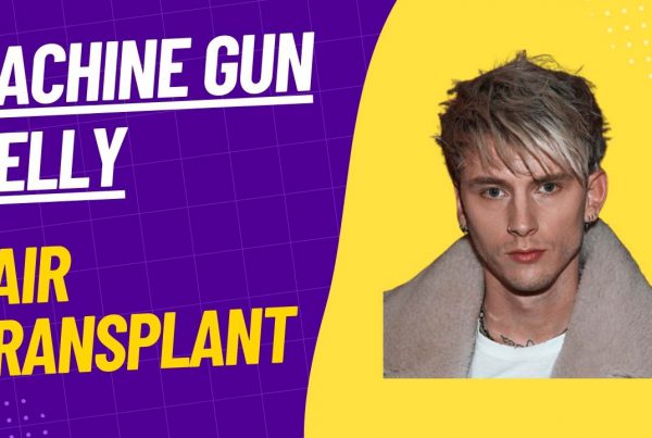 mgk hair transplant