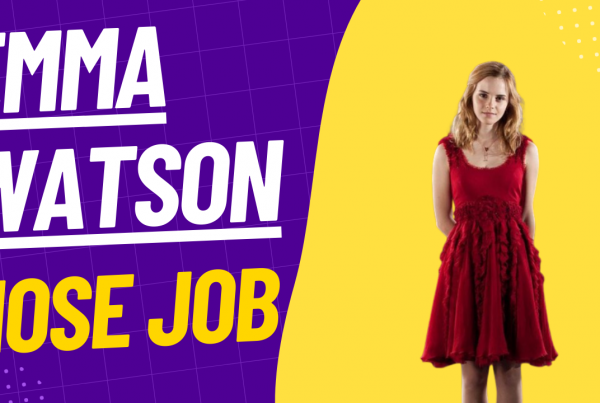 emma watson nose job