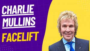 Charlie Mullins facelift photo