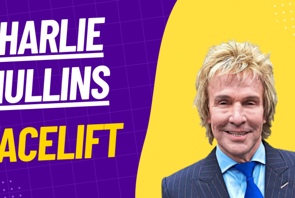 Charlie Mullins facelift photo