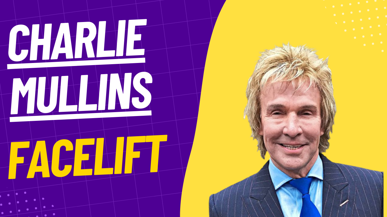 Charlie Mullins' Facelift: A Journey of Transformation