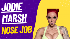 jodie Marsh nose job