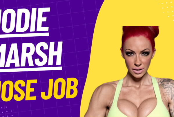 jodie Marsh nose job