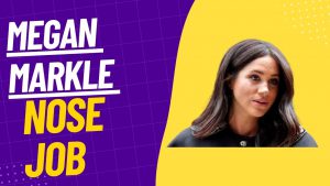 Megan Markle Nose Job Photo
