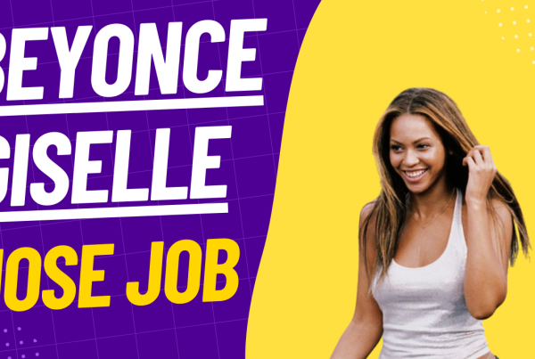 beyonce giselle nose job