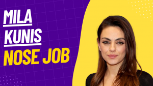 mila kunis nose job