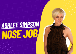 Ashlee Simpson nose job