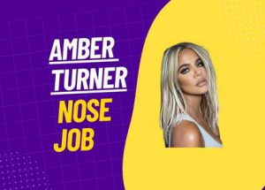 Amber Turner Nose job Photo