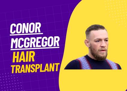 Conor McGregor’s Hair Transplant Journey