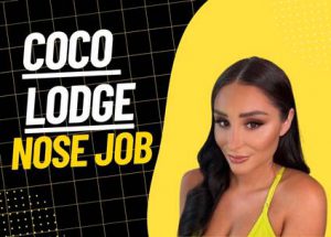 Coco Lodge Nose Job Photo